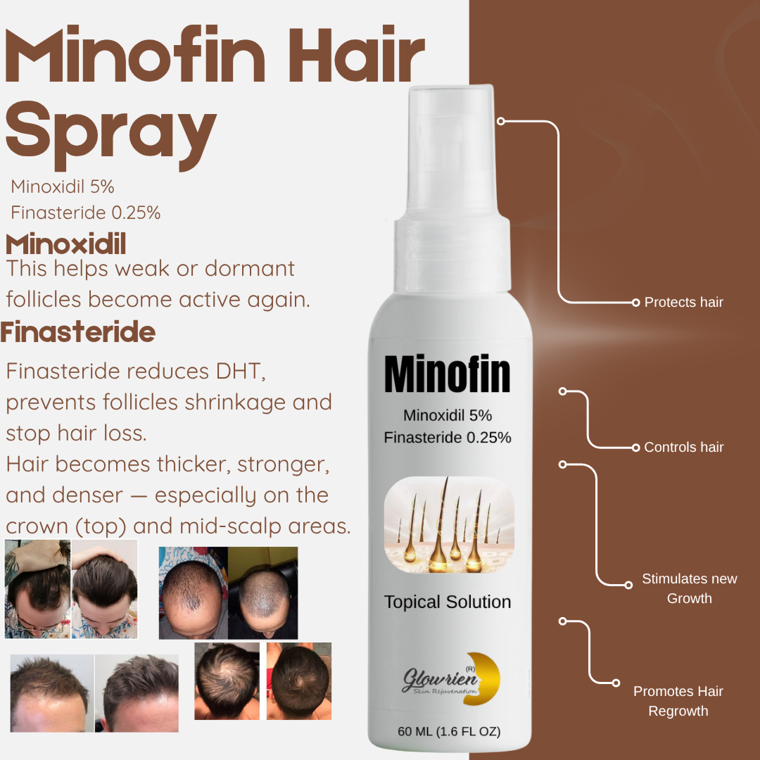 Minofin Hair Spray Minoxidile 5% + Finasteride Combo