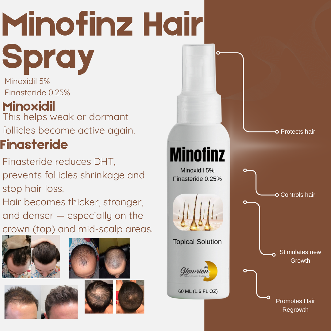 Minofinz Hair Regrowth Spray – Dual Action Formula (Minoxidil 5% + Finasteride 0.25%)